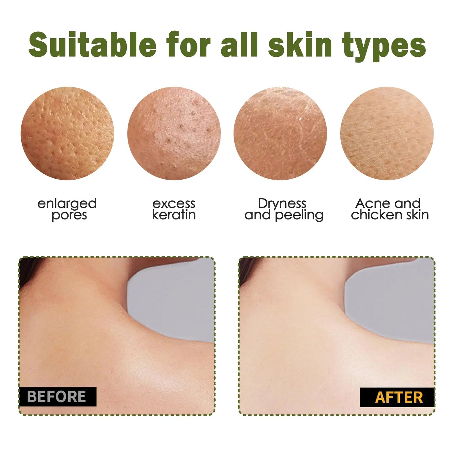 Exfoliating Gloves -Instantly Remove Dead Skin