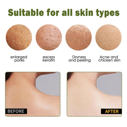 Exfoliating Gloves -Instantly Remove Dead Skin