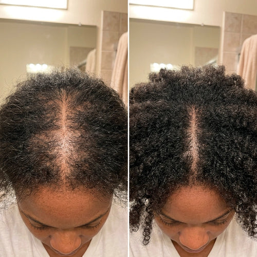 Korean Scalp Revival Bar